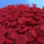 Can a Shortage Of Iron Cause Headaches